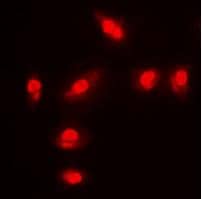 FoxO1/FKHR [p Ser256] Antibody