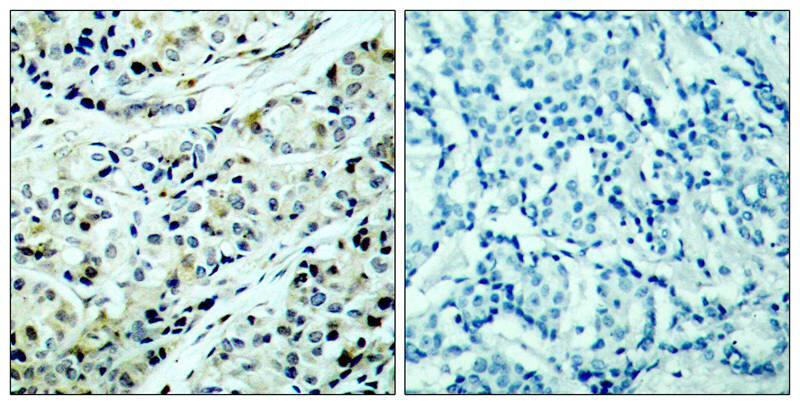 HDAC5 [p Ser498] Antibody - BSA Free