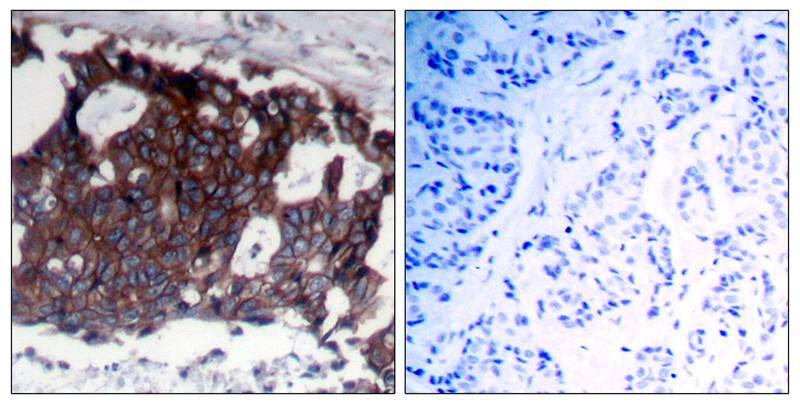 ErbB2/Her2 Antibody - BSA Free