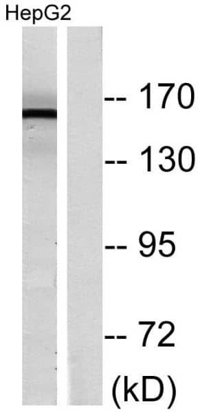 ErbB2/Her2 [p Tyr1248] Antibody