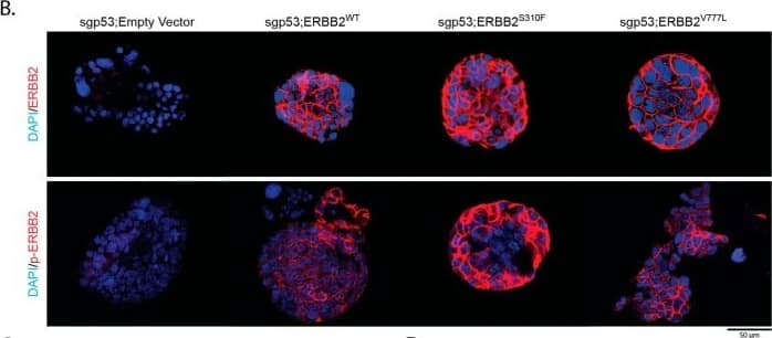 ErbB2/Her2 [p Tyr1248] Antibody