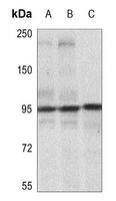 IGF-I R/IGF1R [p Tyr1165, p Tyr1166] Antibody