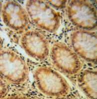 IGF-I R/IGF1R [p Tyr1165, p Tyr1166] Antibody