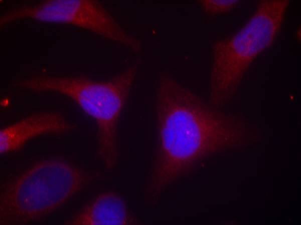 IkB-alpha [p Ser32, p Ser36] Antibody - BSA Free