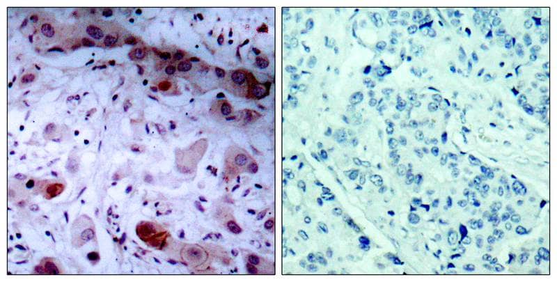Jak1 [p Tyr1022] Antibody