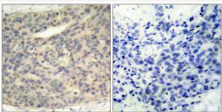 LIM Kinase 1 [p Thr508] Antibody