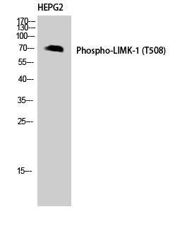 LIM Kinase 1 [p Thr508] Antibody