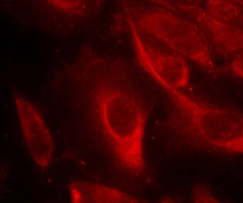 MKK6/MEK6 [p Ser207] Antibody