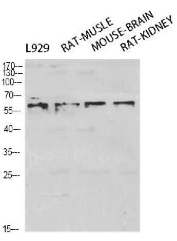 RelA/NFkB p65 [p Ser276] Antibody