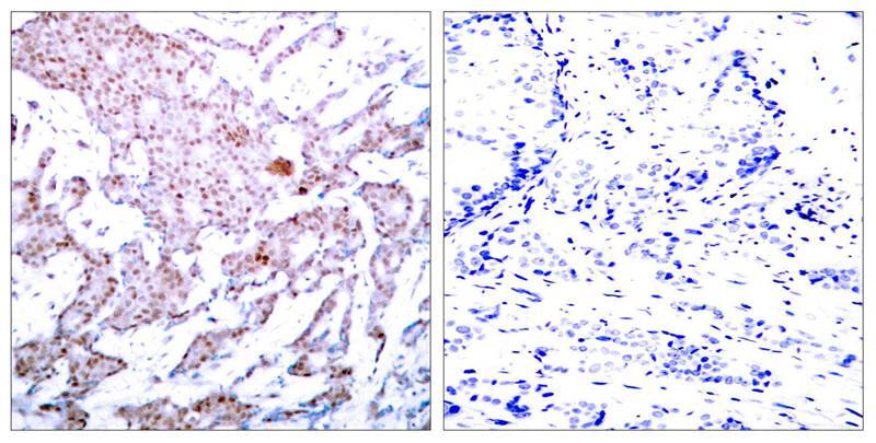 RelA/NFkB p65 [p Ser536] Antibody