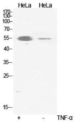 RelA/NFkB p65 [p Ser536] Antibody
