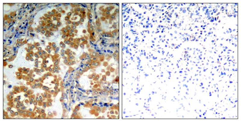 PKC zeta Antibody - BSA Free
