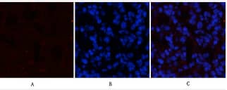 STAT3 [p Tyr705] Antibody