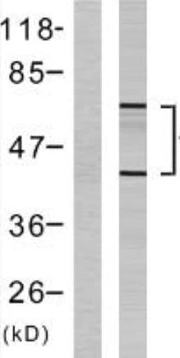 Tau [p Ser262] Antibody