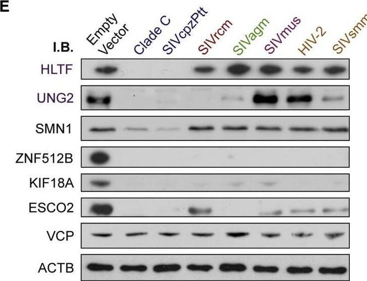 ESCO2 Antibody - BSA Free