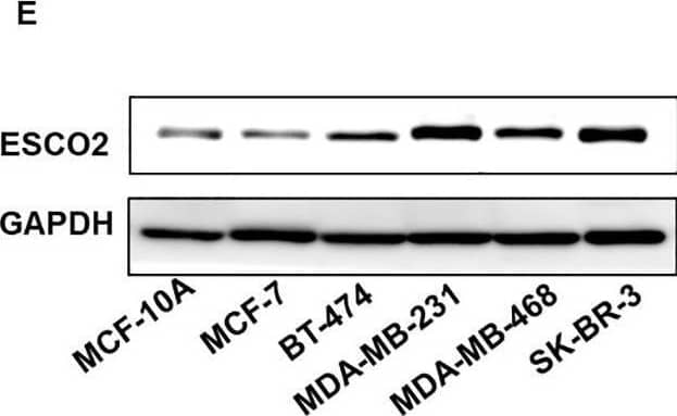 ESCO2 Antibody - BSA Free