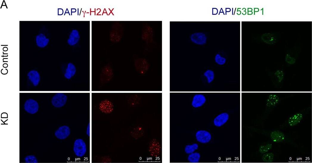 53BP1 Antibody - BSA Free