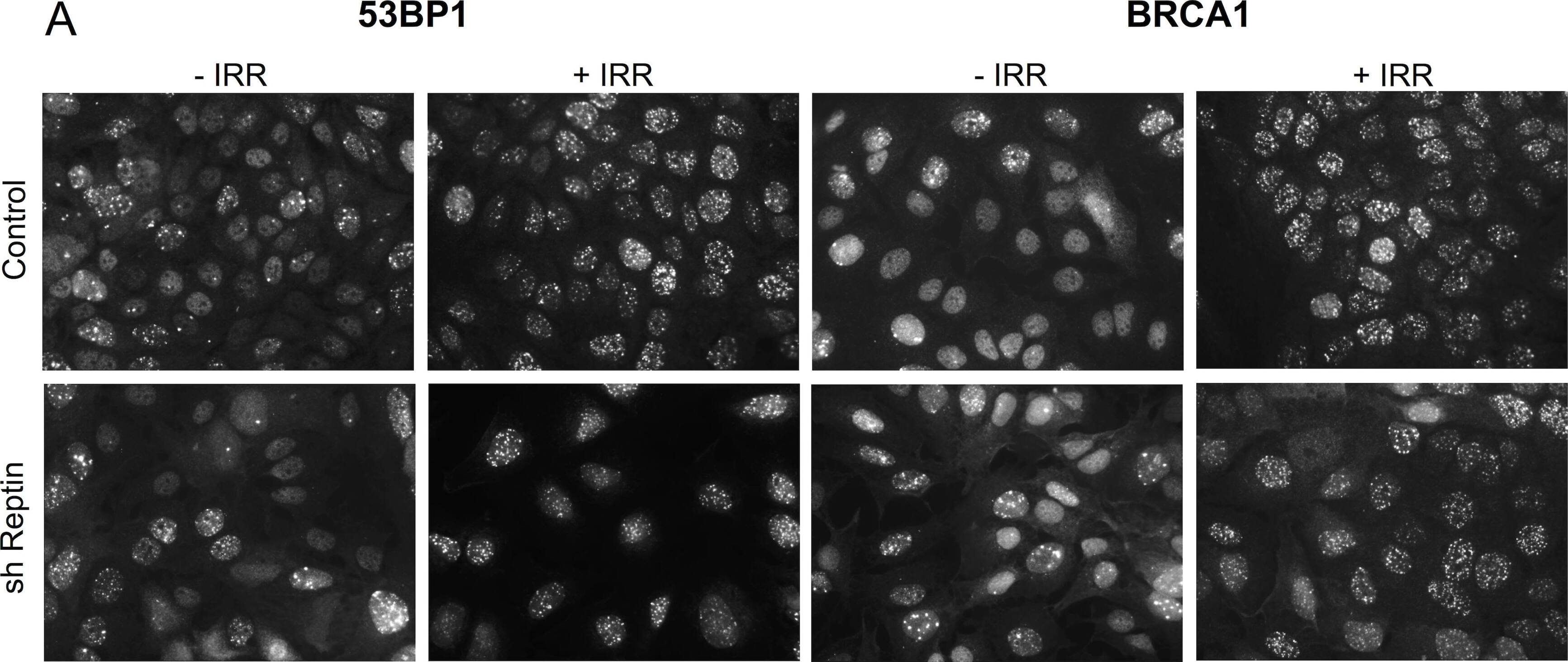 53BP1 Antibody - BSA Free
