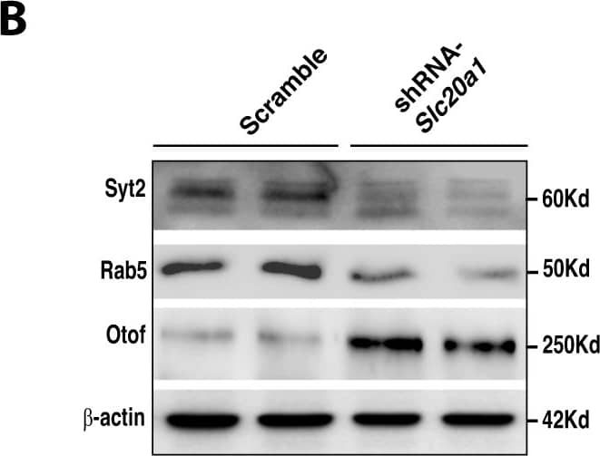 Synaptotagmin 2 Antibody