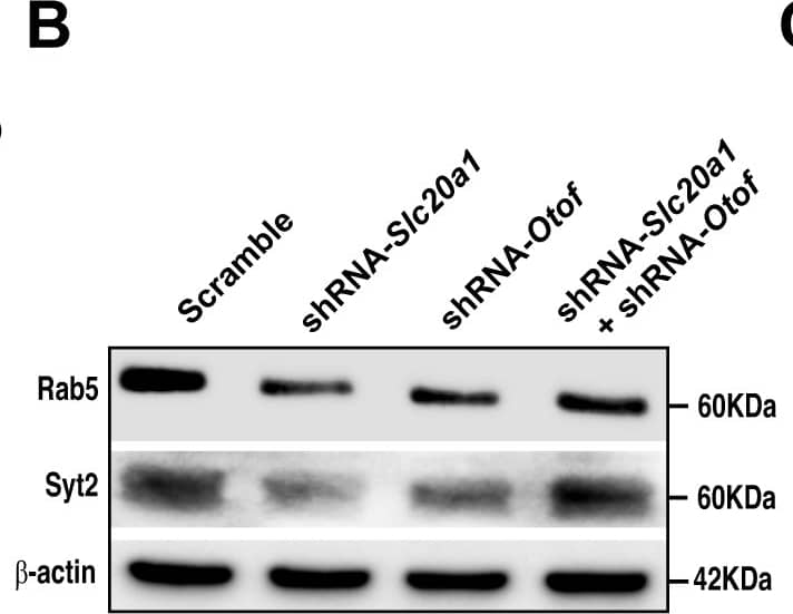 Synaptotagmin 2 Antibody