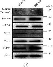 TRPA1 Antibody