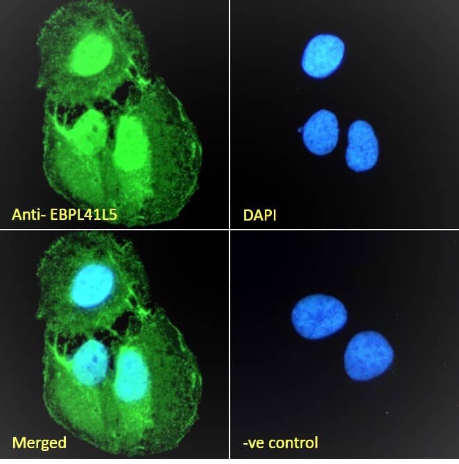 EPB41L5 Antibody