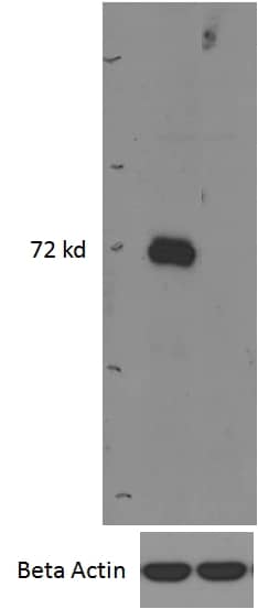 IRAK3 Antibody