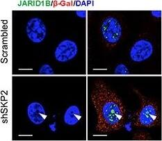 Lysine (K)-specific Demethylase 5B/KDM5B/JARID1B Antibody - BSA Free