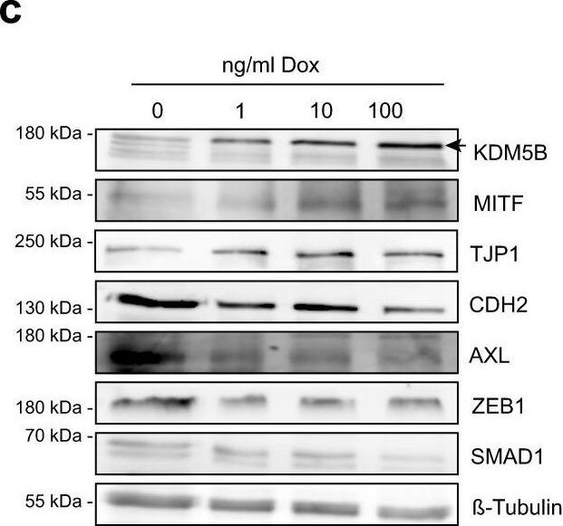 Lysine (K)-specific Demethylase 5B/KDM5B/JARID1B Antibody - BSA Free