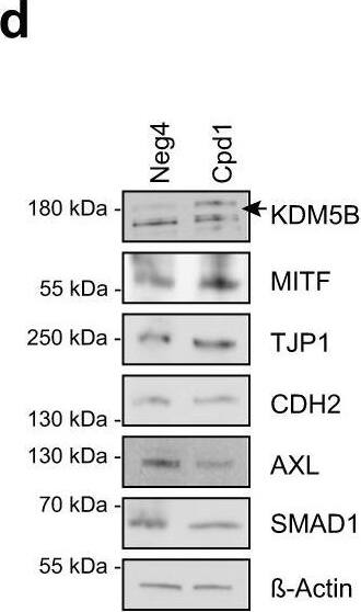 Lysine (K)-specific Demethylase 5B/KDM5B/JARID1B Antibody - BSA Free