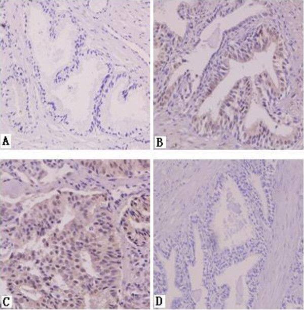 AG-2/AGR2 Antibody - BSA Free
