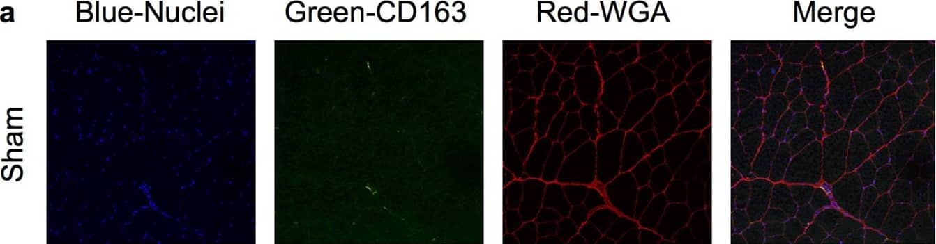 CD163 Antibody (EDHu-1)