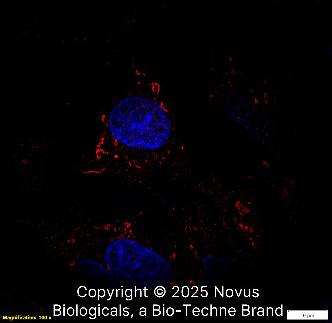 Perilipin-2/ADFP Antibody [Biotin]