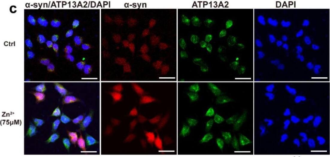 ATP13A2 Antibody - BSA Free