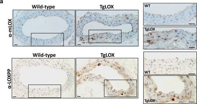 LOX propeptide Antibody - BSA Free