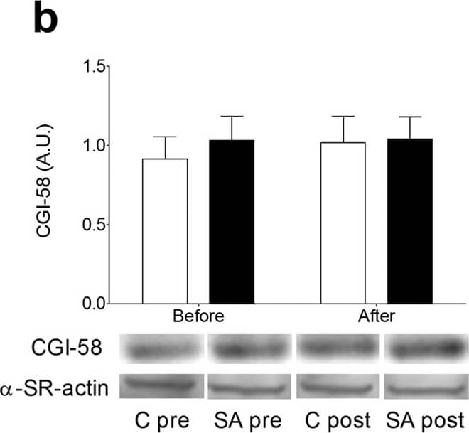 Abhd5 Antibody - BSA Free