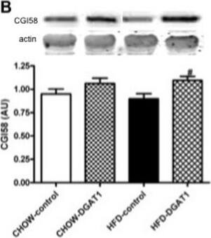 Abhd5 Antibody - BSA Free