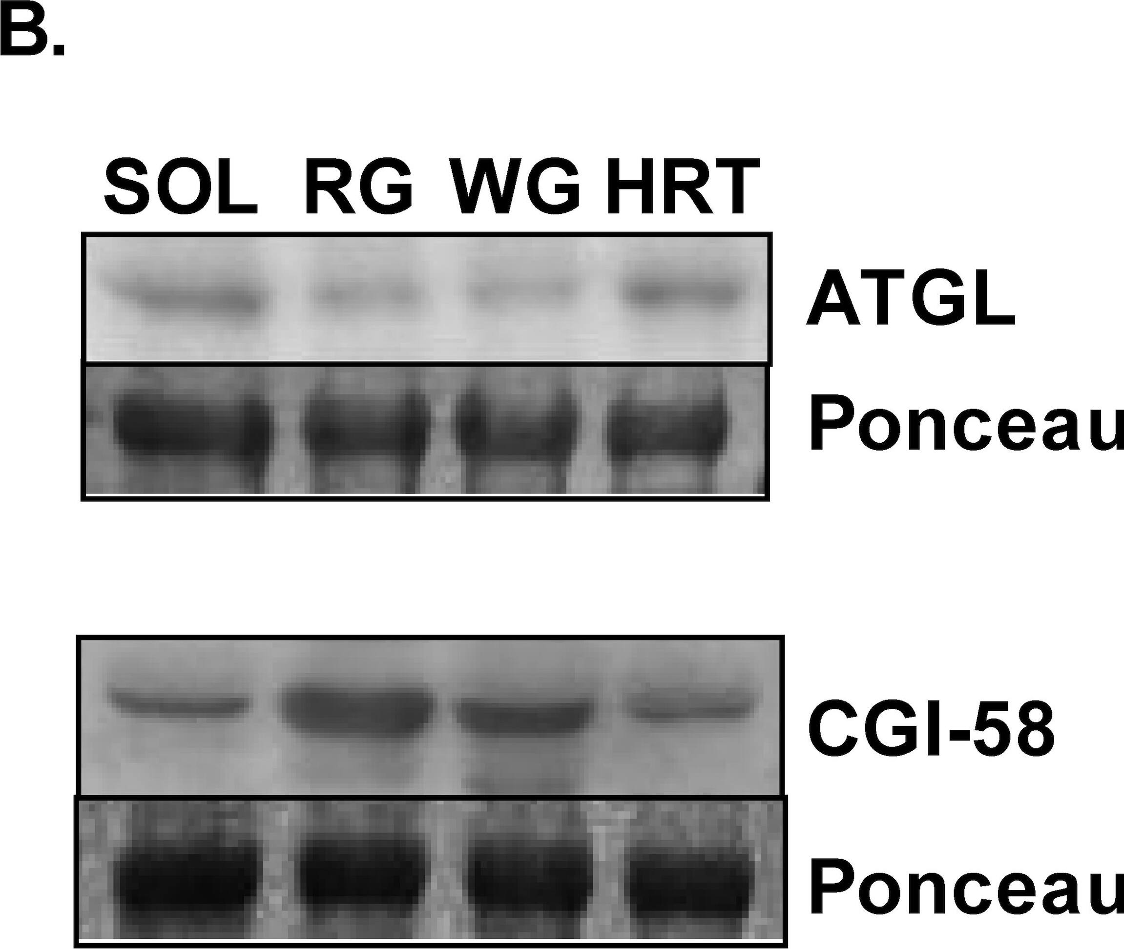 Abhd5 Antibody - BSA Free