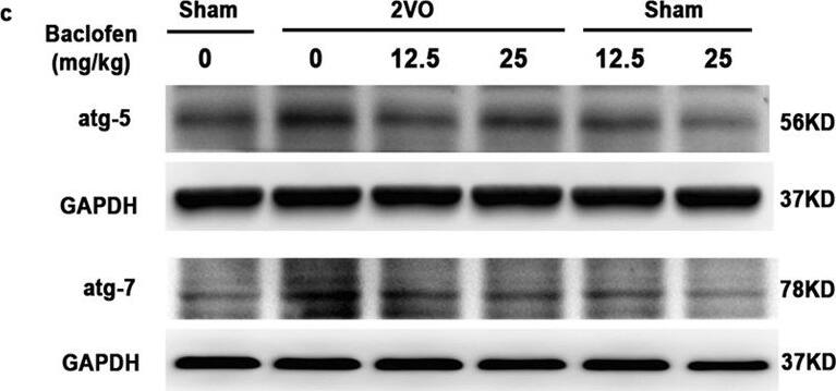ATG5 Antibody - BSA Free