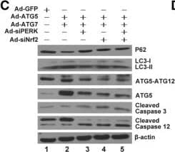 ATG5 Antibody - BSA Free