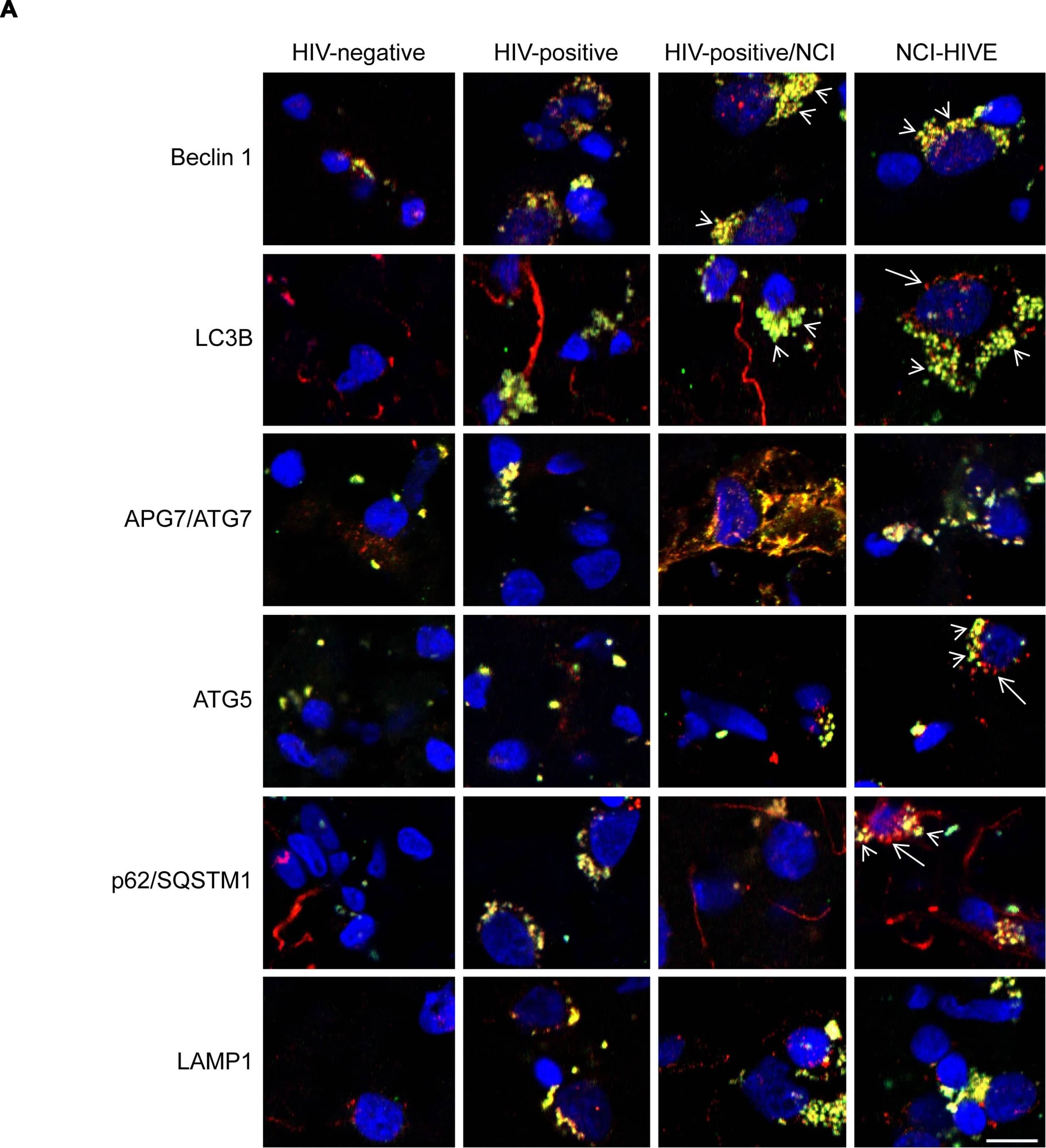 ATG5 Antibody - BSA Free