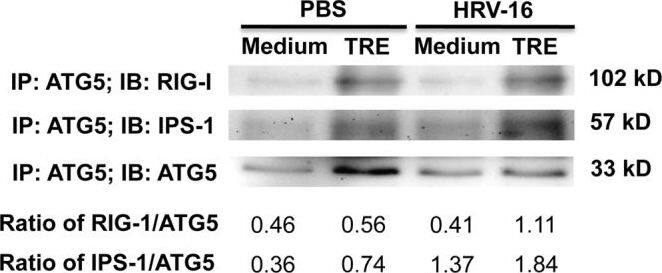 ATG5 Antibody - BSA Free