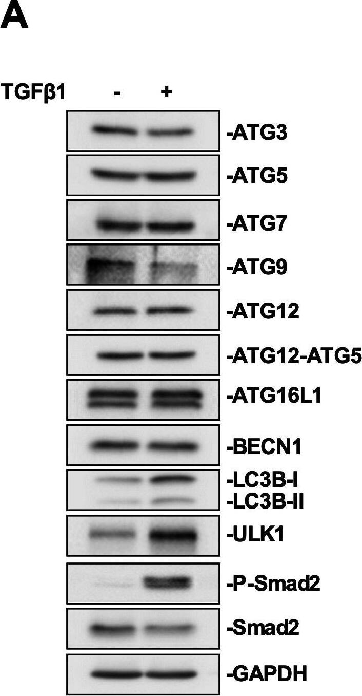 ATG9A Antibody - BSA Free