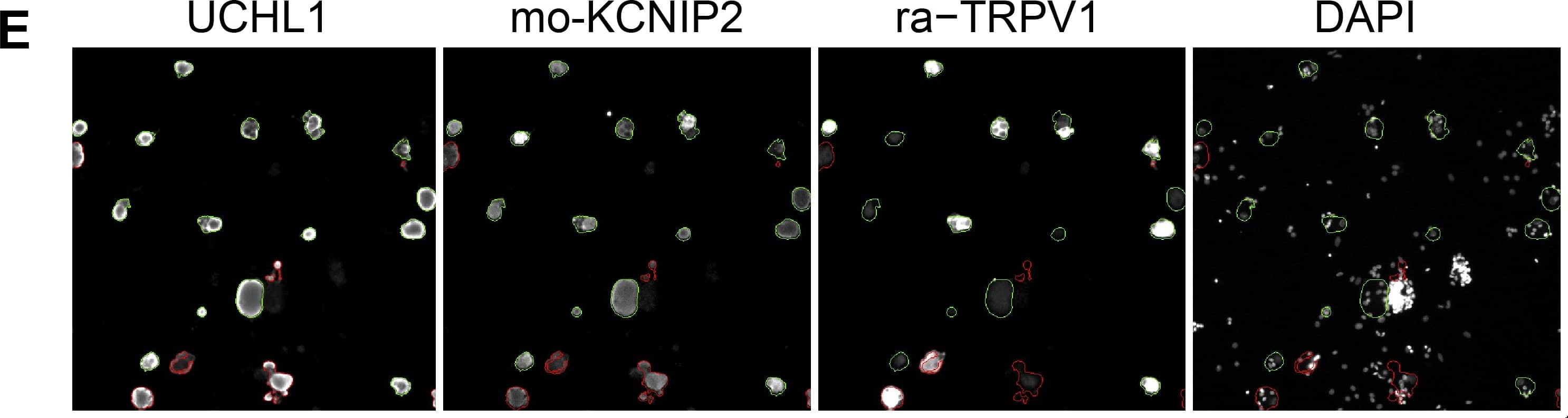 UCH-L1/PGP9.5 Antibody