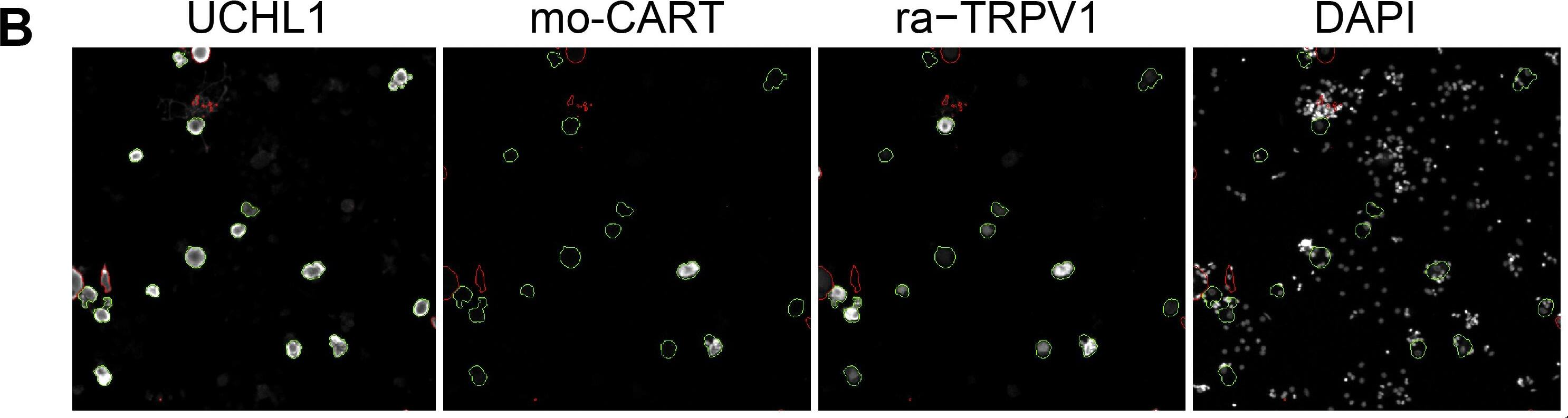 UCH-L1/PGP9.5 Antibody