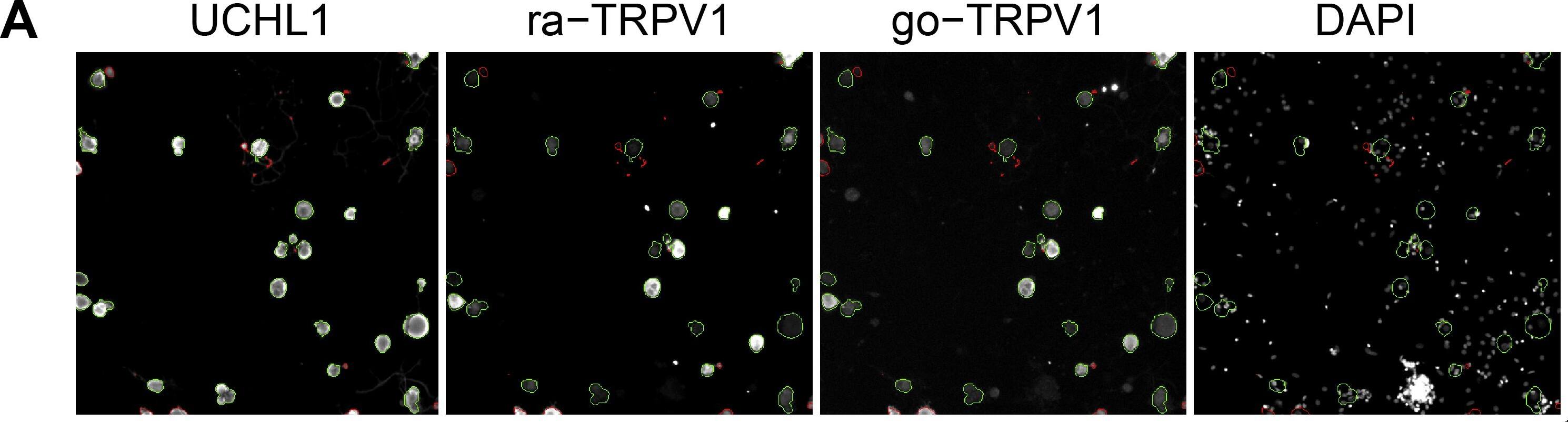 UCH-L1/PGP9.5 Antibody