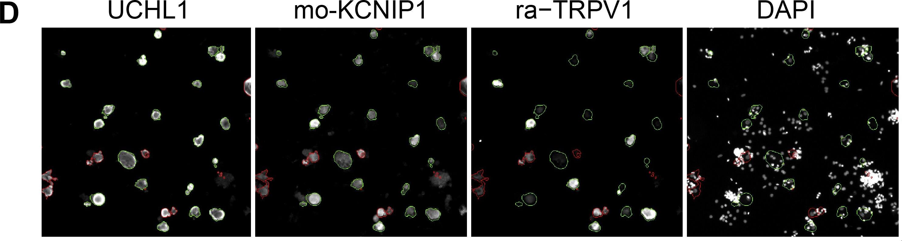 UCH-L1/PGP9.5 Antibody