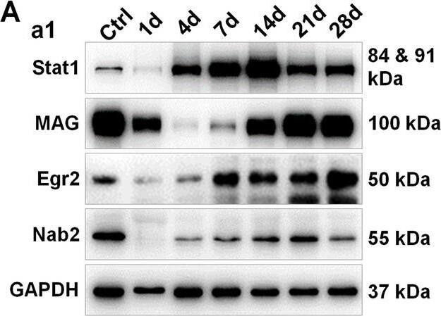 EGR2 Antibody - BSA Free