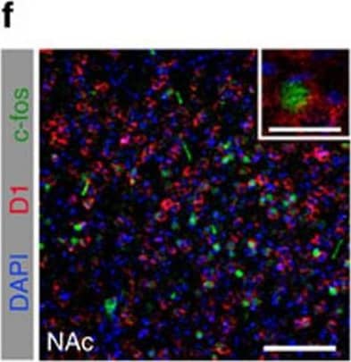Dopamine D1R/DRD1 Antibody (SG2-D1a)