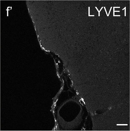 LYVE-1 Antibody (RM0033-4D17) - Azide and BSA Free